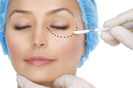 Blefaroplastia